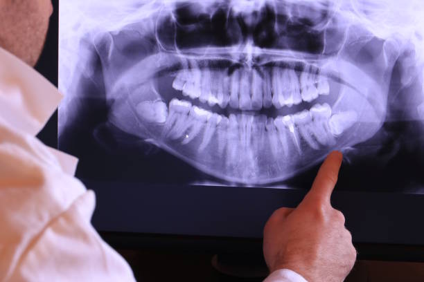 Best Dentist for Severe Toothache  in Elkhart, KS