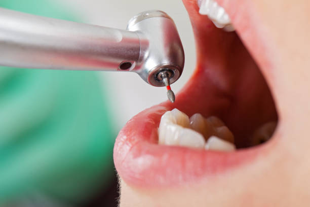 Best Emergency Gum Pain Relief  in Elkhart, KS